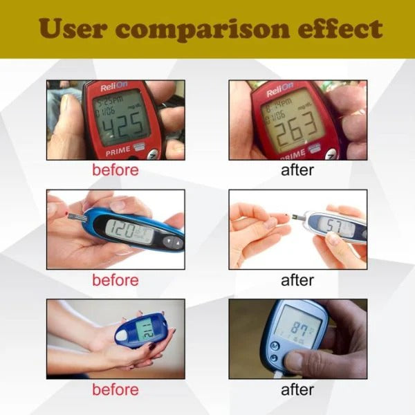 South Moon Acupressure Sugar controller Wristband - Buy One Get One Free