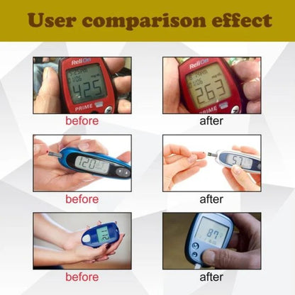 South Moon Acupressure Sugar controller Wristband - Buy One Get One Free